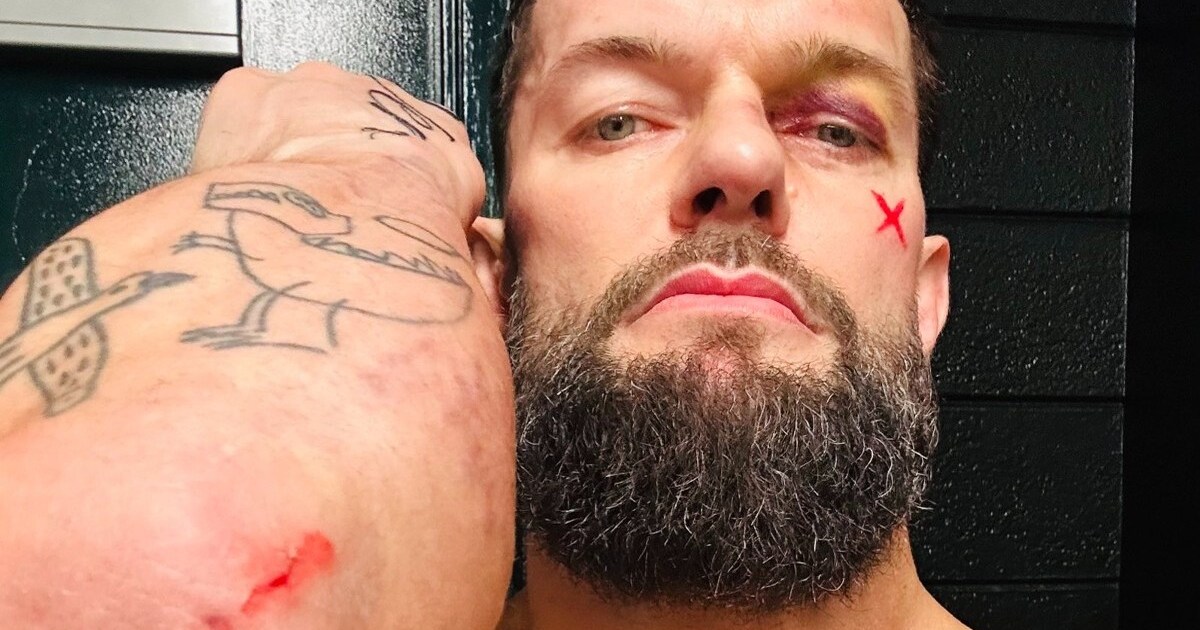 Finn Bálor Looks At The ‘Bright Side’ Of Loss At WrestleMania 40