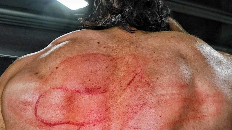 Drew McIntyre Shows Off His Wounds After CM Punk Whipped Him With A Belt On WWE RAW