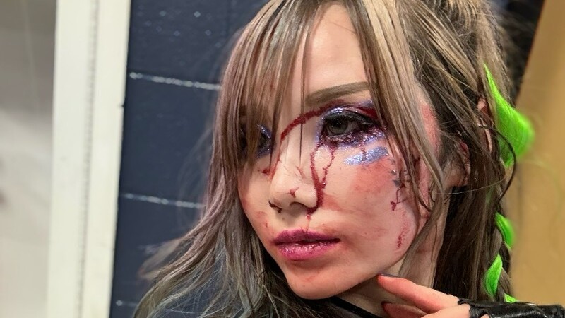 Report: Injury Update On Kairi Sane After 9/2 WWE RAW